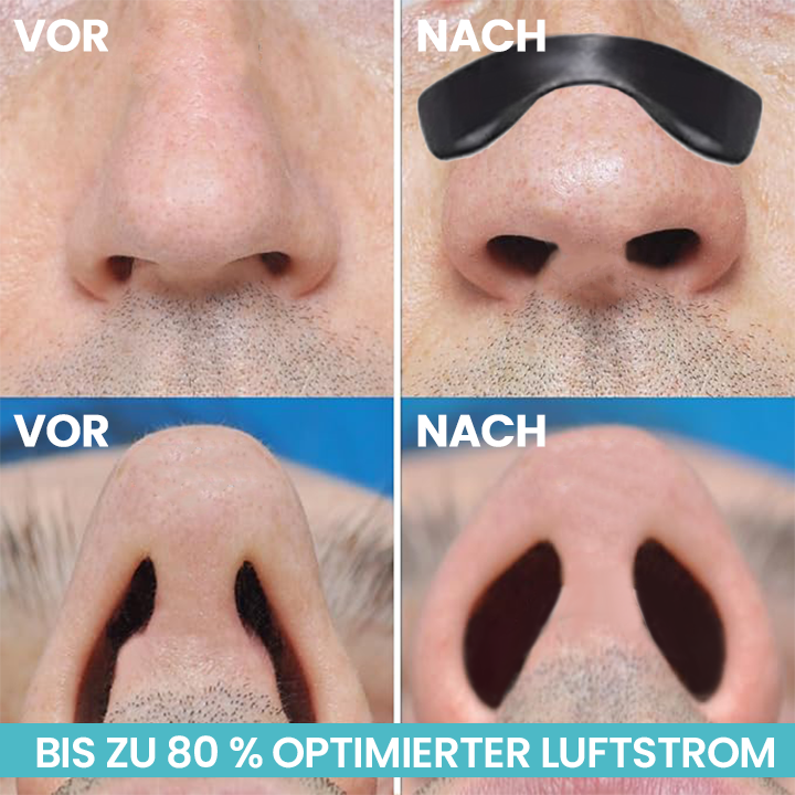 LIMETOW™ Easy Breathing magnetischer Nasenstreifen