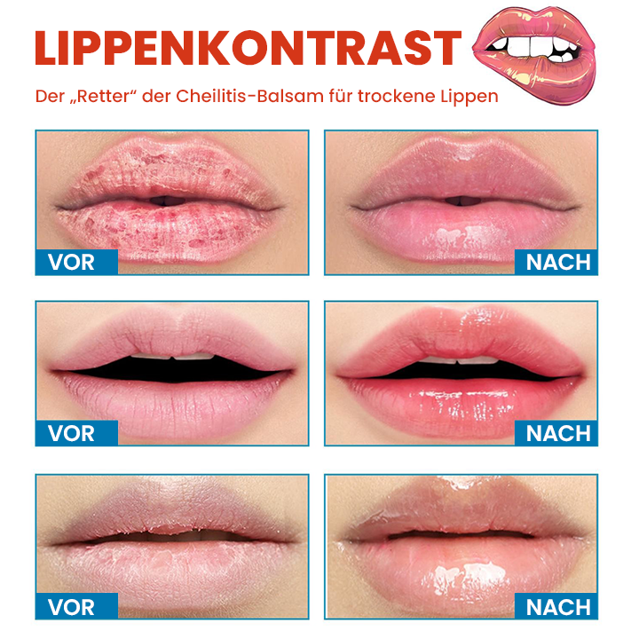 LIMETOW™ Cheilitis-Creme