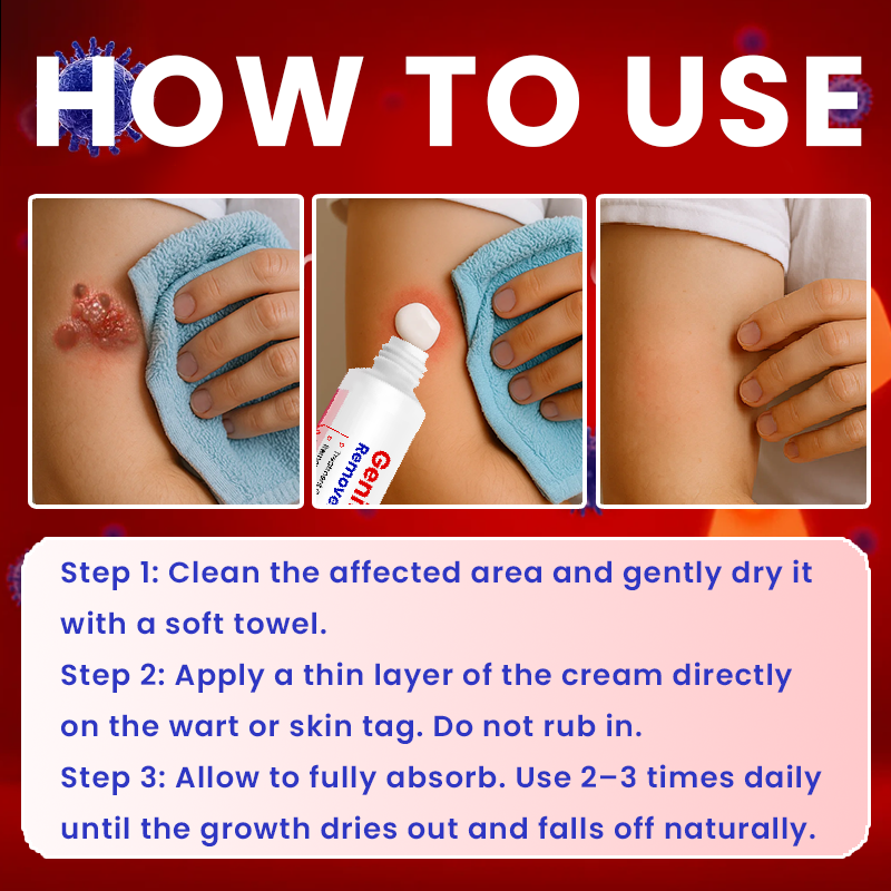LIMETOW® Genital Warts Remover Cream