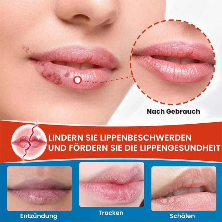 LIMETOW™ Cheilitis-Creme