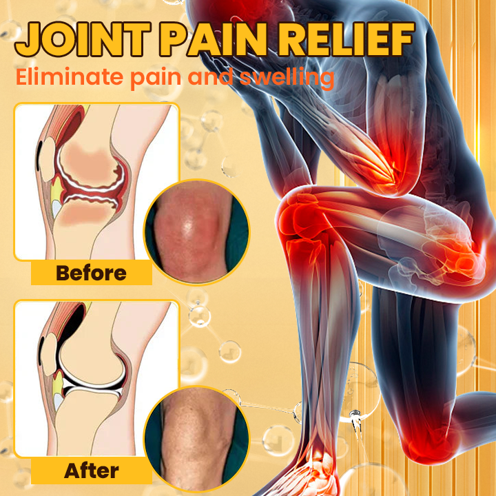 LIMETOW® Snake Venom Arthritis Therapy Spray