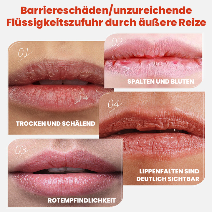LIMETOW™ Cheilitis-Creme