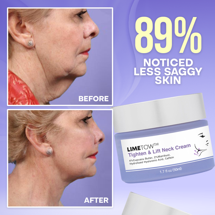 LIMETOW™ Tighten & Lift Neck Cream