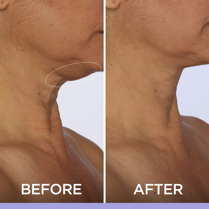 LIMETOW™ Tighten & Lift Neck Cream