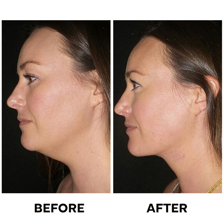 LIMETOW™ Tighten & Lift Neck Cream