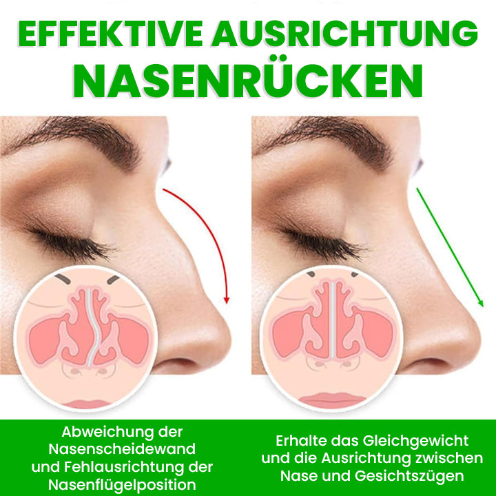 LIMETOW™ Nasenlift-Formungsöl