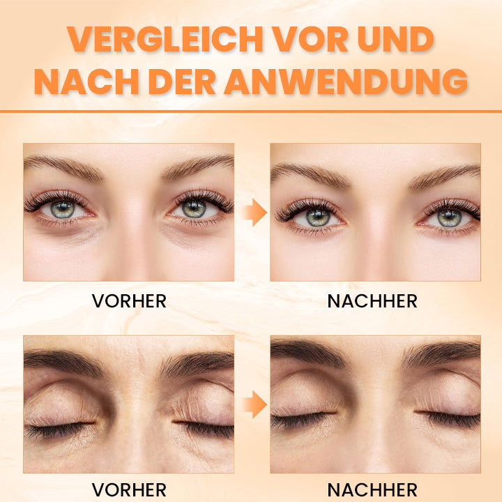 LIMETOW™ Augenbalsam mit Vitamin C