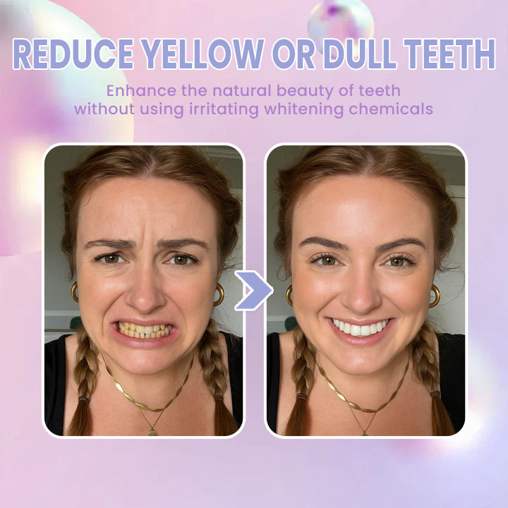 LIMETOW® Smile Pen
