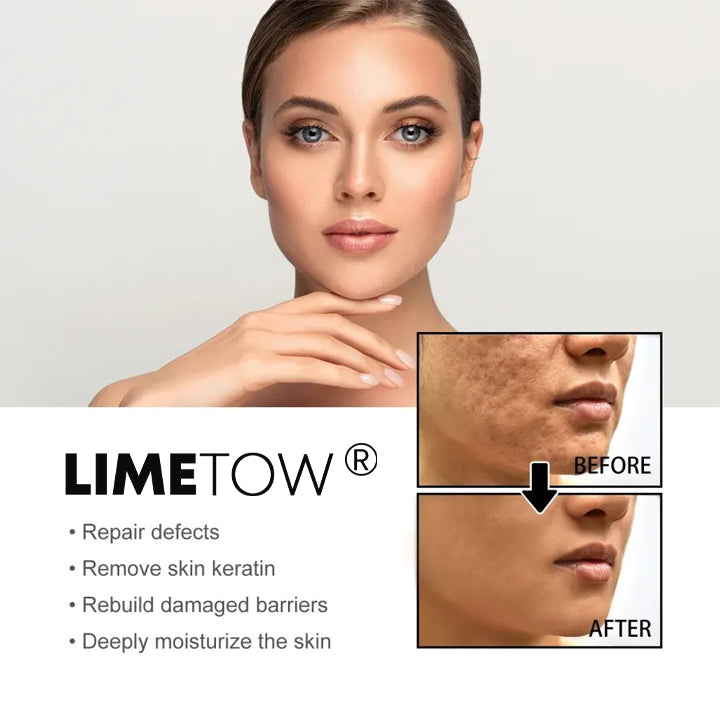 10% LIMETOW® Spots Removal Serum 🎉Second Item half price🎉