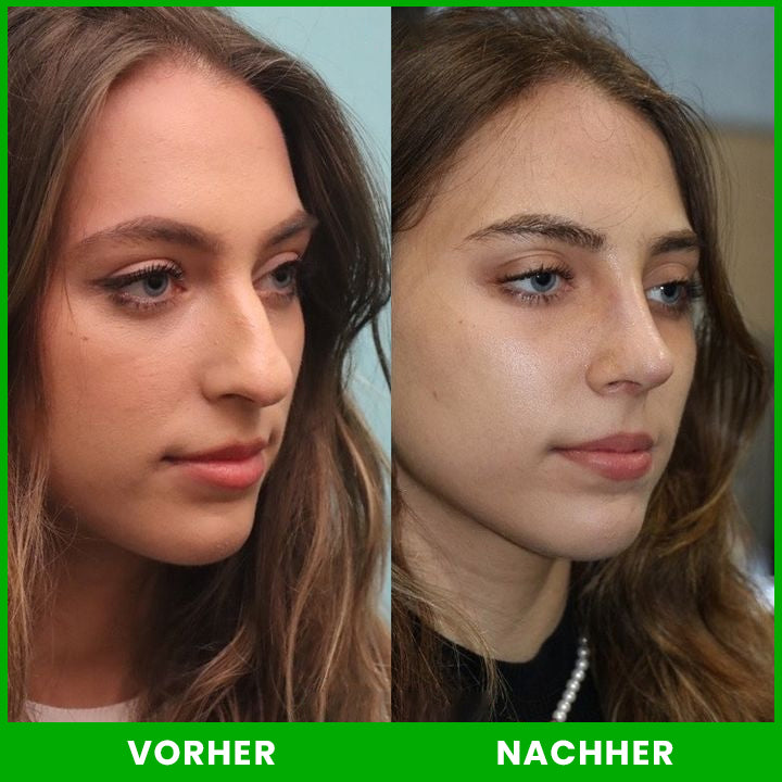 LIMETOW™ Nasenlift-Formungsöl