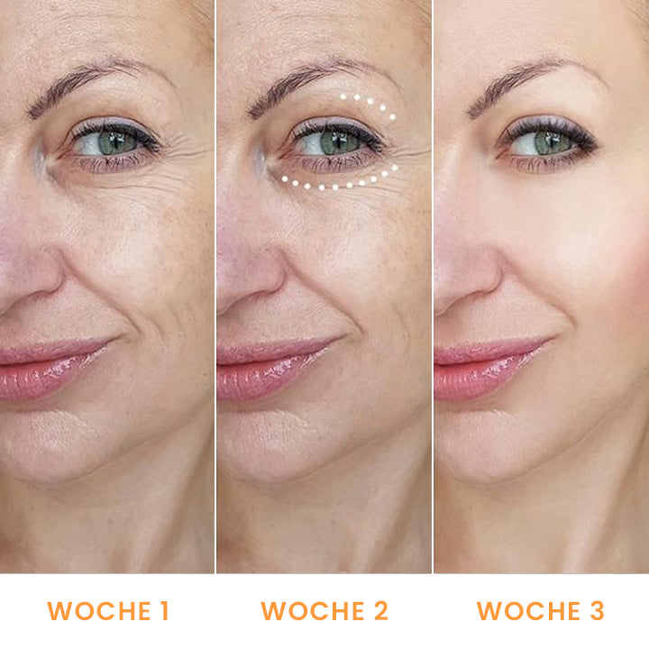 LIMETOW™ Augenbalsam mit Vitamin C