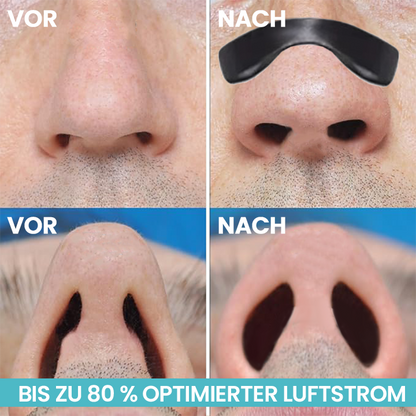 LIMETOW™ Easy Breathing magnetischer Nasenstreifen