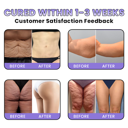 LIMETOW® GET-DREAMY Overnight Toning Whip