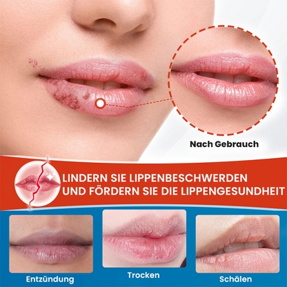 LIMETOW™ Cheilitis-Creme