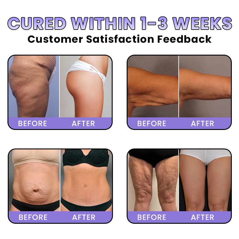 LIMETOW® GET-DREAMY Overnight Toning Whip