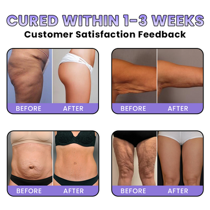 LIMETOW® GET-DREAMY Overnight Toning Whip