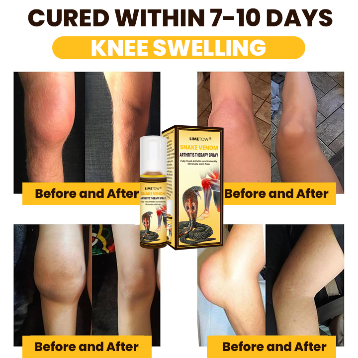 LIMETOW®  Snake Venom Arthritis Therapy Spray