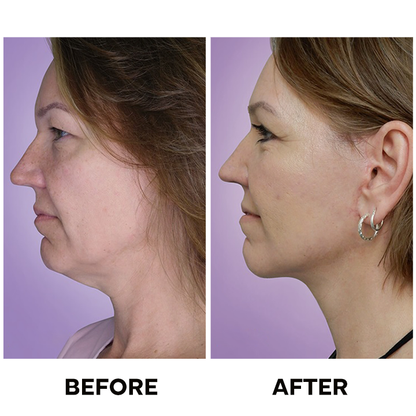LIMETOW™ Tighten & Lift Neck Cream