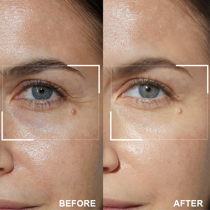 👨‍⚕️💐Made and Shipped from USA✨LIMETOW™ Retinol Eye Stick💝LAST DAY 50%OFF