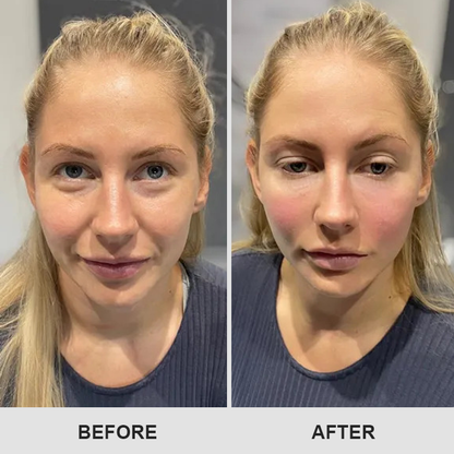👨‍⚕️💐Made and Shipped from USA✨LIMETOW™ Retinol Eye Stick💝LAST DAY 50%OFF