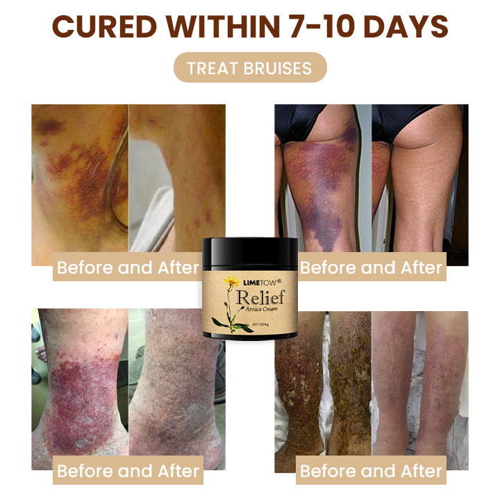 LIMETOW™ Relief Arnica Cream