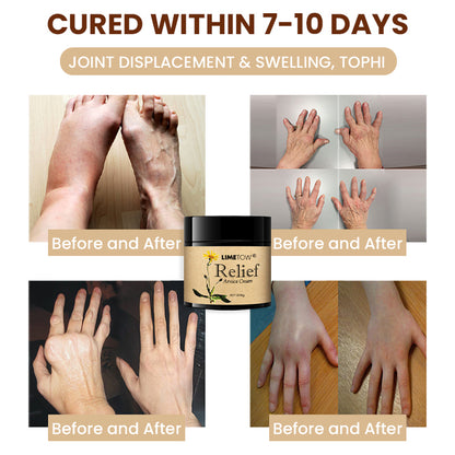 LIMETOW™ Relief Arnica Cream