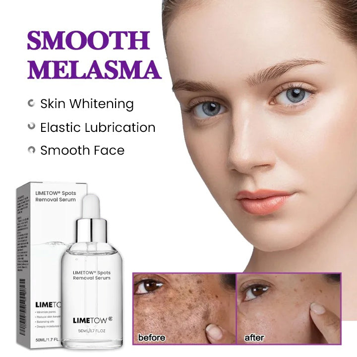 10% LIMETOW® Spots Removal Serum 🎉Second Item half price🎉