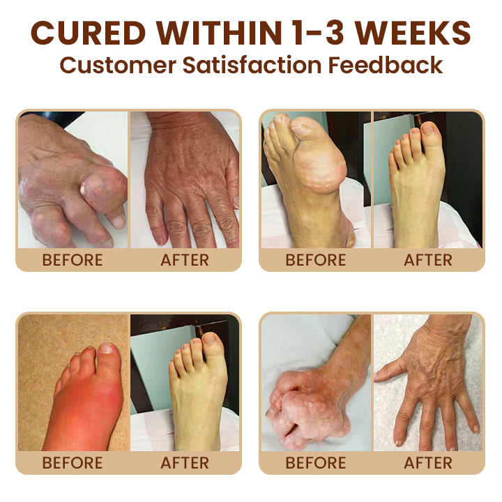 LIMETOW™ Relief Arnica Cream